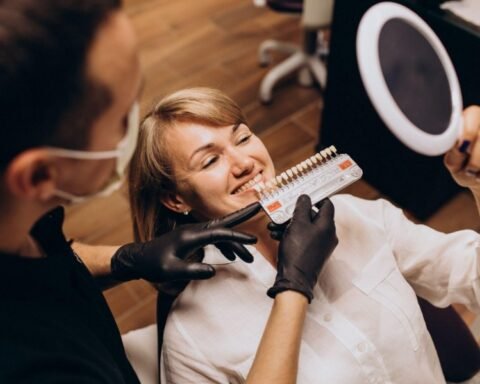 composite bonding or veneers
